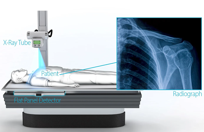 The Future of Radiology: Smart Ray DR Systems Explained